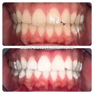 ライトビューティー 錦糸町店のエステ・リラクイメージ