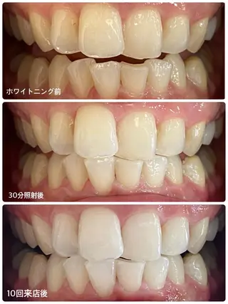 ホワイトニングサロン ラウレアのその他イメージ