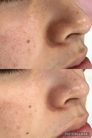 インディバサロン　ソレイユ所属・indiba soleilのエステ・リラクイメージ