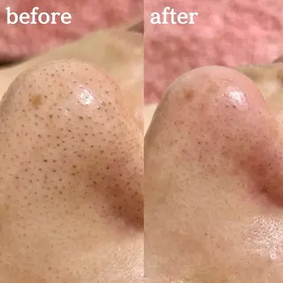 毛穴専門サロンLatiele所属・毛穴専門サロン Latieleのエステ・リラクイメージ