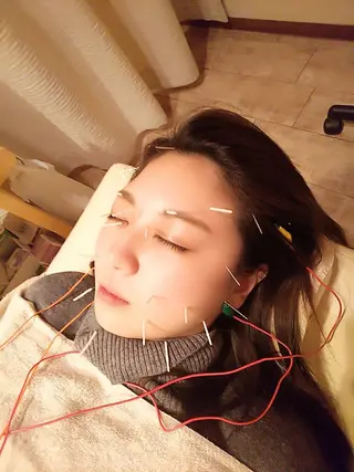 むくみたるみ専門☆ 美容鍼・小顔矯正のエステ・リラクイメージ