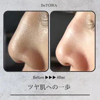 BeTOWA所属・BeTOWA 毛穴洗浄／Wax脱毛のエステ・リラクイメージ