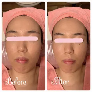 透明感の肌Lino malieのエステ・リラクイメージ