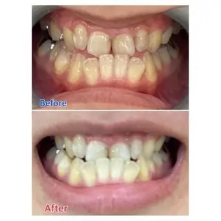 M渋谷店所属・Ｍ渋谷 ホワイトニングのエステ・リラクイメージ