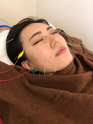 SBHメディカル美容サロン所属・🐱美容鍼・整体 SBHメディカル👍のエステ・リラクイメージ