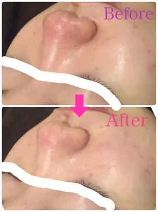 ショート カラー パーマ ヘアアレンジ メンズ キッズ ネイル マツエク・マツパ ‍痩身＆ボディ 結果出し🌟丹野のエステ・リラクイメージ