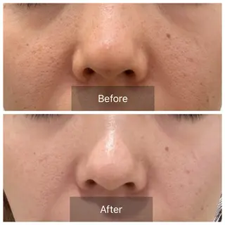 毛穴が見えなくなるサロン  Horo所属・岡 えり子のエステ・リラクイメージ