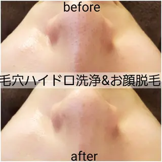 メンズ 小顔・美肌ケア専門 Diva北浜のエステ・リラクイメージ