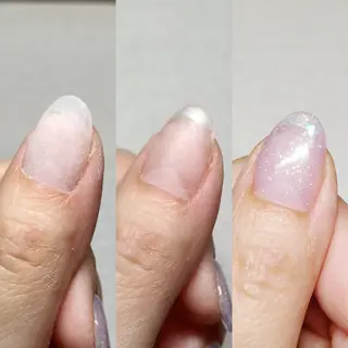 ネイル 深爪矯正/爪育成ケア manie nailのネイルデザイン