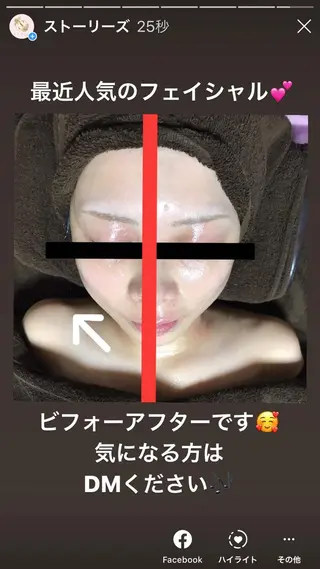 首・肩こり専門リンパ ケアサロンSENKAのエステ・リラクイメージ