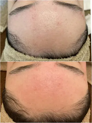 Le cherien所属・Le cherien ルシェリアのエステ・リラクイメージ