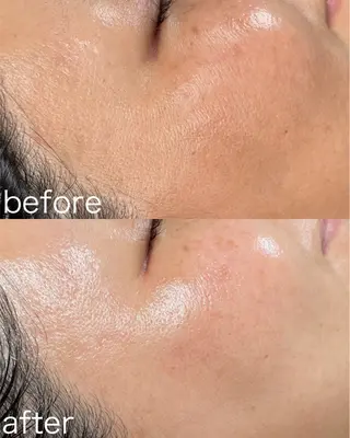 医療提携Beauty SalonMuseのエステ・リラクイメージ