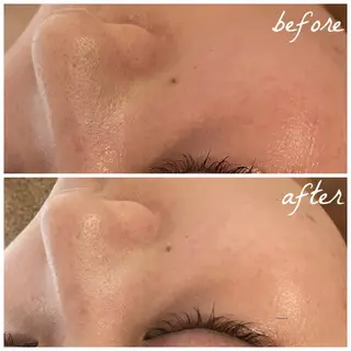 メンズ メナード岐阜茜部 杉浦のエステ・リラクイメージ