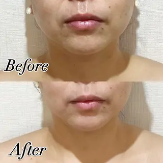 Lim(ライム)樋口 フェイシャル・ボディのエステ・リラクイメージ