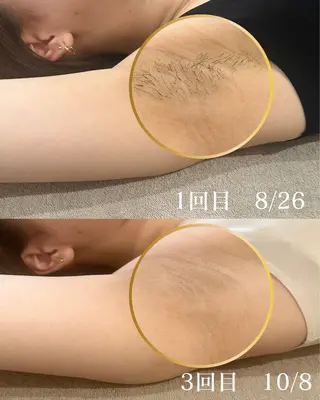 oui-oui　ウィウィ所属・oui-oui 磐田脱毛のエステ・リラクイメージ