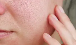 肌質改善エステRISMIN所属・肌質改善エステ RISMINのエステ・リラクイメージ