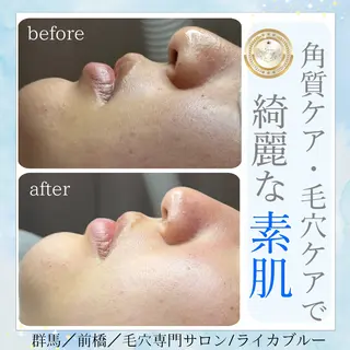 毛穴専門サロン ライカブルーのエステ・リラクイメージ