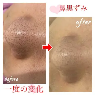 セミロング カラー パーマ ヘアアレンジ メンズ キッズ ネイル マツエク・マツパ 四つ星サロン🎖 腸＆ニキビケアに特化のエステ・リラクイメージ