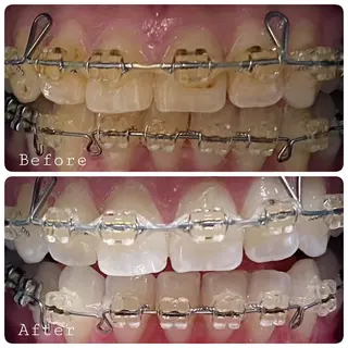 ほわいと あざぶのマツエク・マツパデザイン