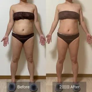 未病ケアサロン EMINY所属・未病ケアサロン EMINY☺︎勝俣のエステ・リラクイメージ