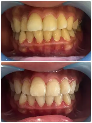 Belle beauty salon所属・Bellebeau tysalonのエステ・リラクイメージ