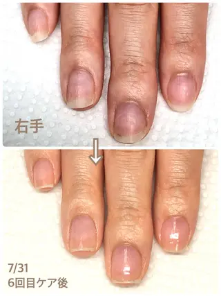 ネイル プライベートネイルサロンPause(ポーズ)所属・自爪育成ネイルサロン Pause(ポーズ)のネイルデザイン