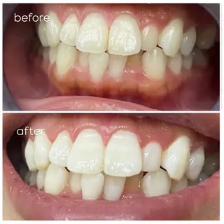 エクシア津駅前店所属・セルフホワイトニング エクシア津駅前店のその他イメージ