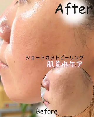 リンパ・小顔サロン PuReTeのエステ・リラクイメージ