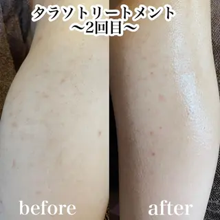 浜野 恵美のエステ・リラクイメージ