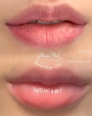 LiLL by Andre beauty所属・LiLL 熊本のエステ・リラクイメージ