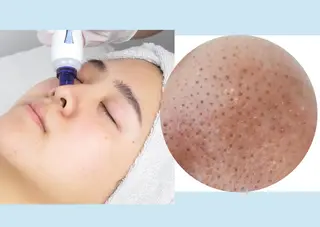 CLEAD 赤坂見附店のエステ・リラクイメージ