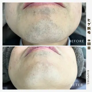 メンズ Rappore; 心斎橋 みずきのエステ・リラクイメージ