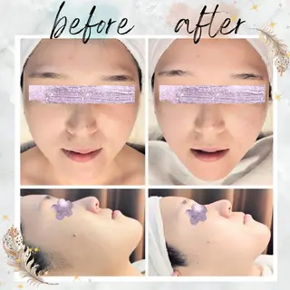 NARIS beautysalon 所属・Takahashi  Hiromiのエステ・リラクイメージ