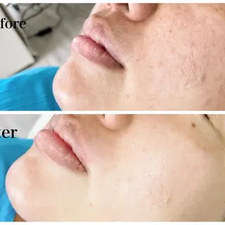 多摩境Beauty Salon  ViVi所属・多摩境ViVi chinamiのエステ・リラクイメージ