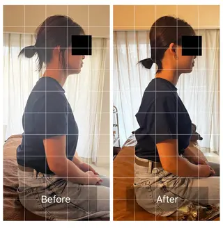 心斎橋痩身ダイエット 韓国.美容鍼.小顔のエステ・リラクイメージ