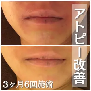 セミロング カラー パーマ ヘアアレンジ メンズ キッズ ネイル マツエク・マツパ アイブロウ 触れたくなる モテ肌へ...❤︎のエステ・リラクイメージ