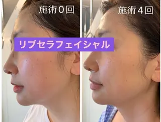 Private Salon Prunelle所属・プライベートサロン プリュネルのエステ・リラクイメージ