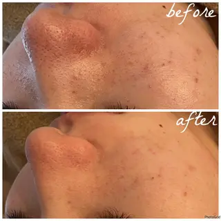 メンズ メナード岐阜市茜部 杉浦のエステ・リラクイメージ