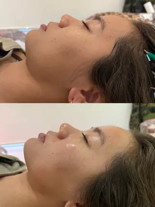 美容鍼灸サロン mahoroba院長のエステ・リラクイメージ