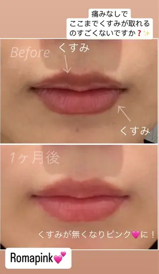 エステサロン-mignon-所属・mignon 脱毛/ ローマピンク/耳ツボのその他イメージ