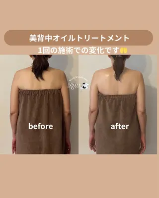 【頭痛、睡眠改善】 salon RUUのエステ・リラクイメージ