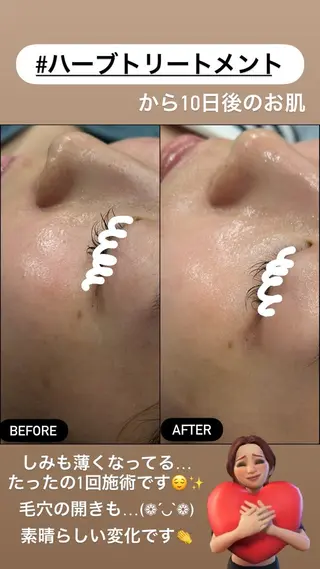 LiZA エステティックサロンのエステ・リラクイメージ