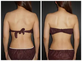 美肌脱毛専門店 イオンモール春日部店のエステ・リラクイメージ