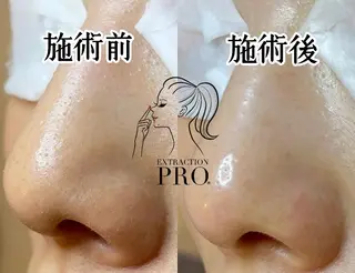 Lipula リプラ所属・毛穴ツヤ肌専門    Lipulaのエステ・リラクイメージ