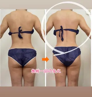 ショート カラー パーマ ヘアアレンジ メンズ キッズ ネイル マツエク・マツパ ‍痩身＆ボディ 結果出し🌟丹野のエステ・リラクイメージ