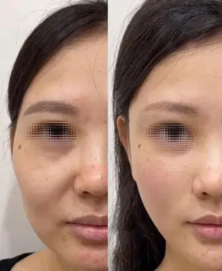 マツエク・マツパ aliaハイフ&水光ジェットサロン所属・aliaハーブ水光店 エステティシャン募集のエステ・リラクイメージ