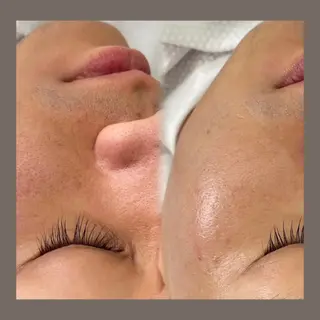 愛維美水光美肌専門店所属・愛維美水光美肌専門店 メンズレディースokのエステ・リラクイメージ