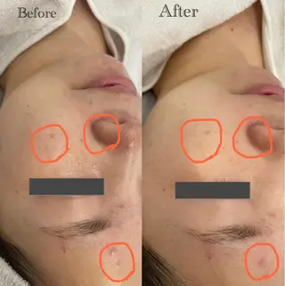 ナリスビューティースタジオデアイム倉敷所属・森口 美空のエステ・リラクイメージ