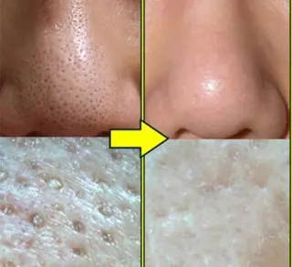 肌質改善美肌専門店 A-beautyのエステ・リラクイメージ