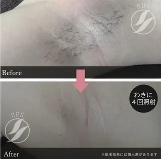 noel de mi 前川亜里沙のエステ・リラクイメージ